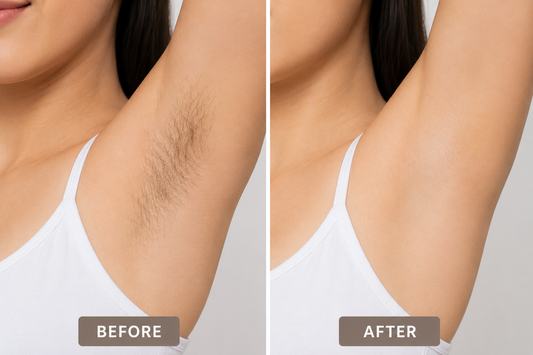 Iconic Sapphire™
IPL Hair Removal & Skin Care System